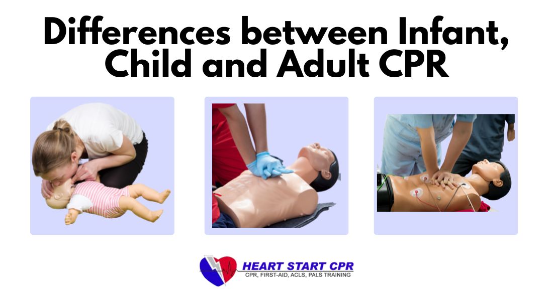 Differences between Child, Adult and Infant CPR