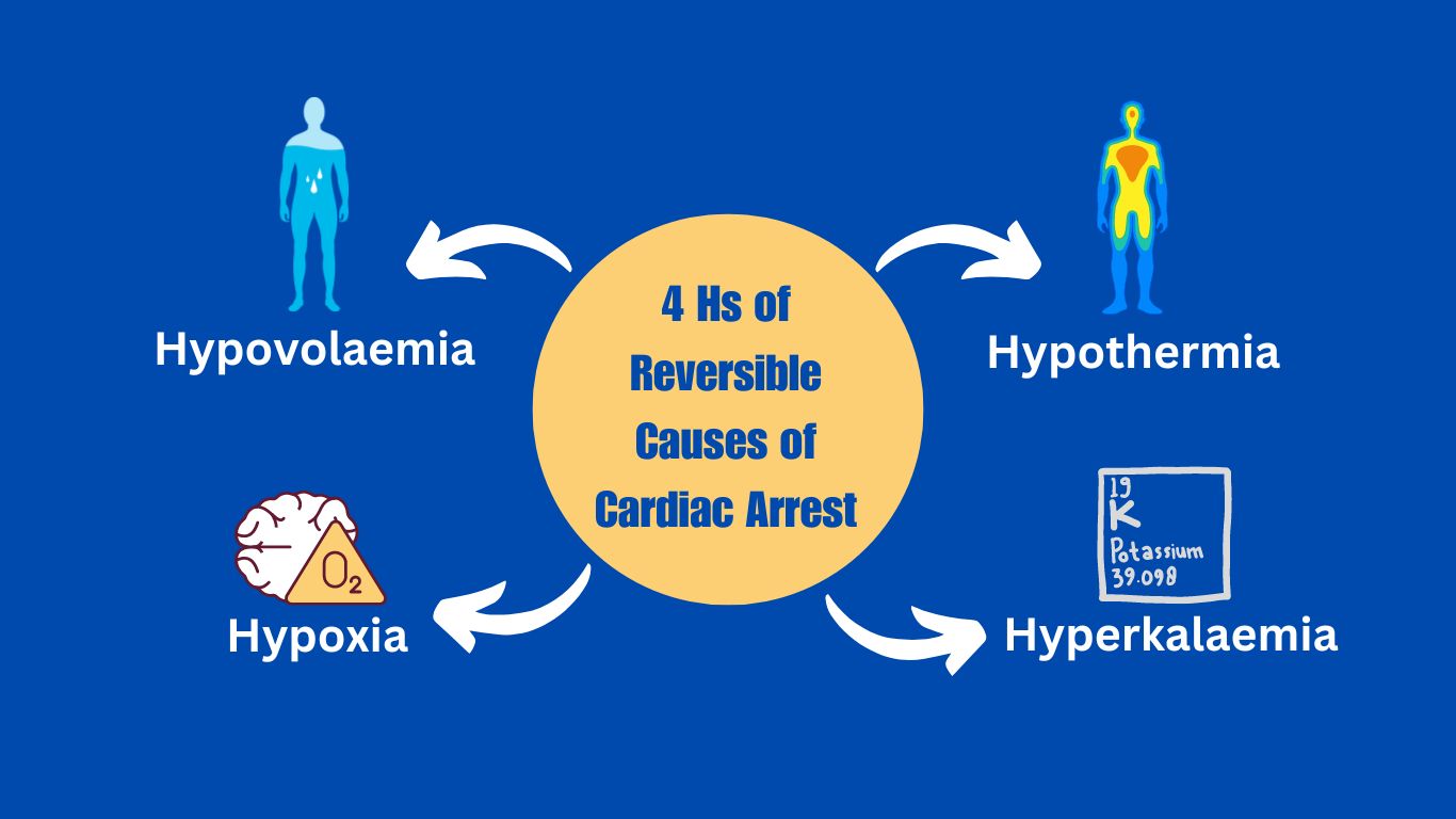 4 Hs of Reversible Causes of Cardiac Arrest
