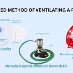 Preferred Method of Ventilating Patient