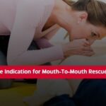 What is the Indication for Mouth-To-Mouth Rescue Breaths?